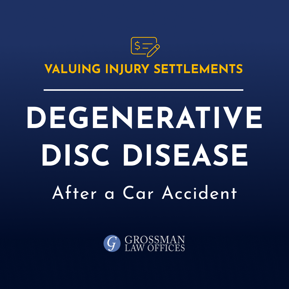 Acuerdo promedio para la enfermedad degenerativa del disco después de un accidente de coche